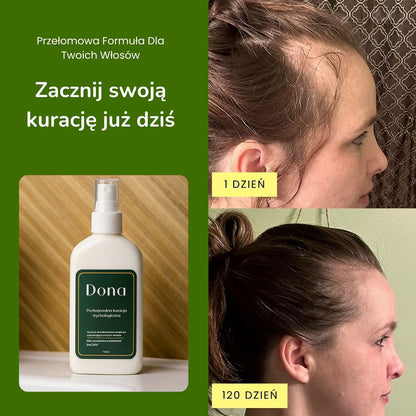 Profesjonalna kuracja trychologiczna - Dona