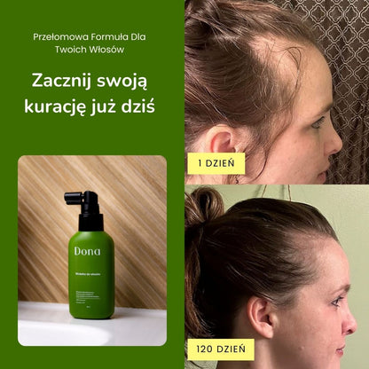 Profesjonalna kuracja trychologiczna 3HC - Dona