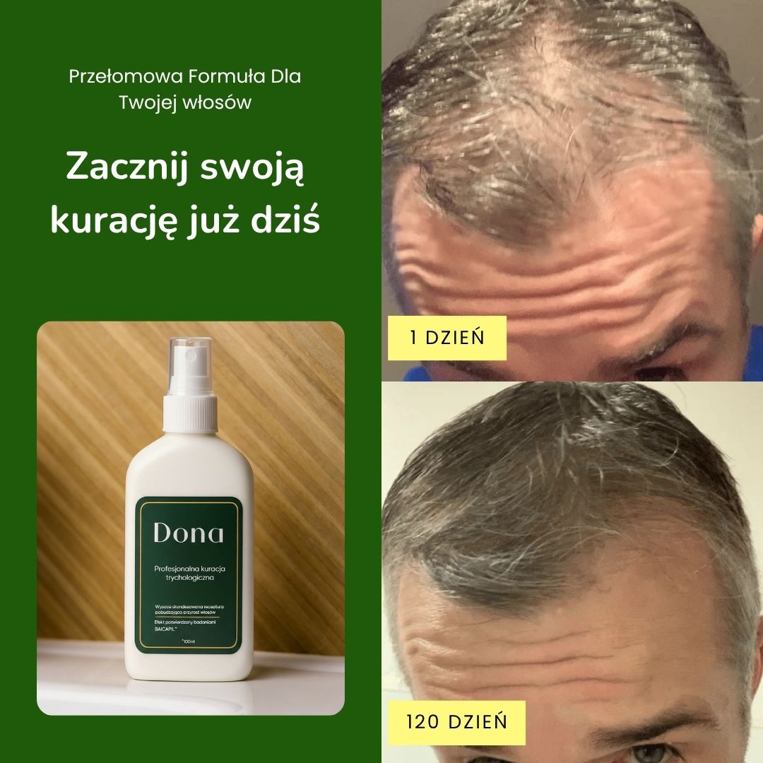 Profesjonalna kuracja trychologiczna dla mężczyzn - Dona