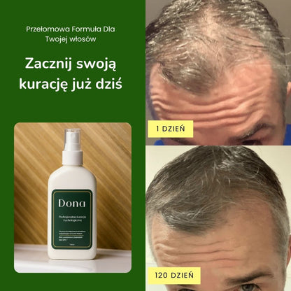 Profesjonalna kuracja trychologiczna dla mężczyzn - Dona